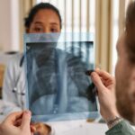mesothelioma compensation, early mesothelioma detection, mesothelioma diagnosis benefits, asbestos lung cancer payout, mesothelioma claim tips, asbestos exposure compensation, mesothelioma legal settlement, early detection mesothelioma, asbestos cancer payout, mesothelioma lawsuit assistance
